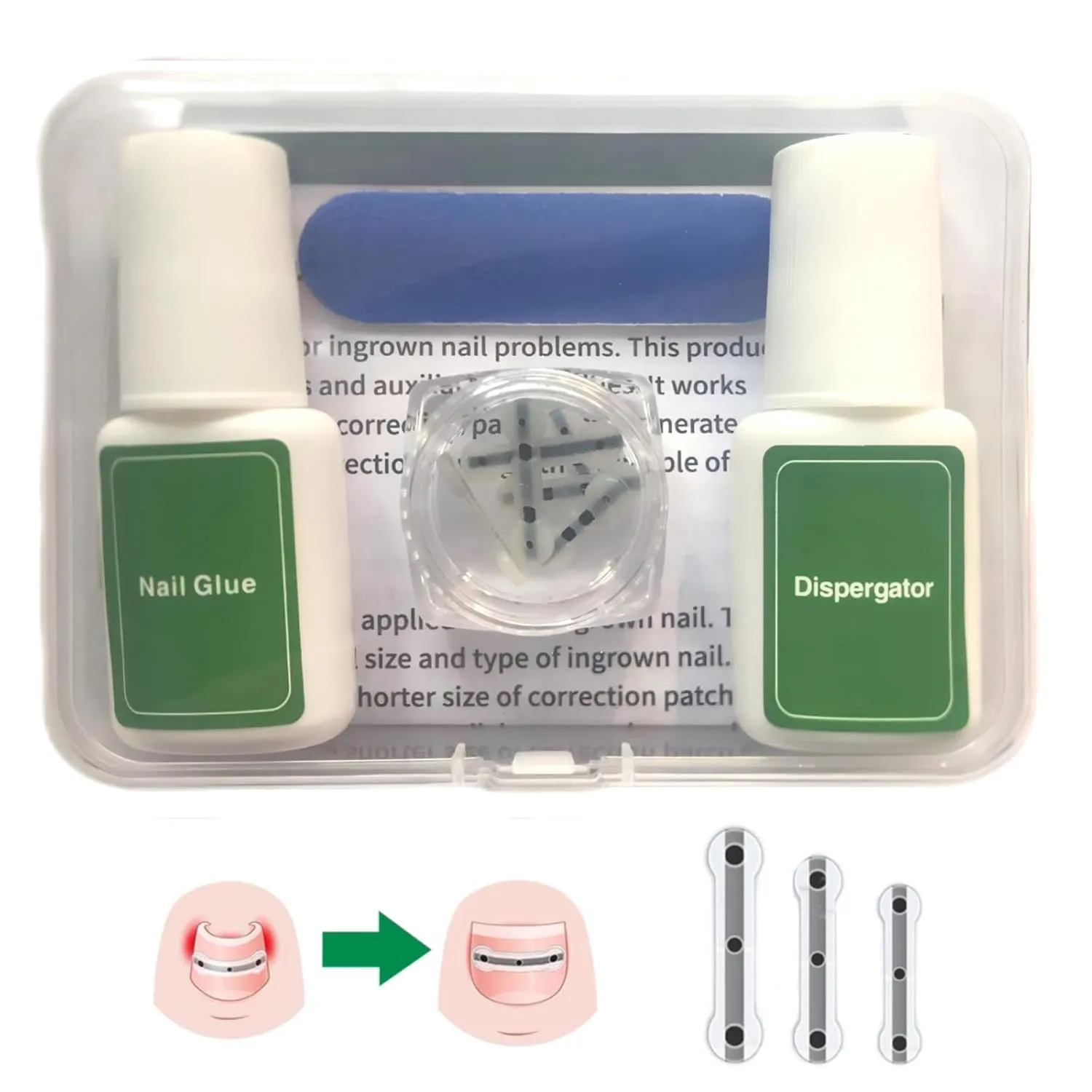 Titanium Alloy Silicone Ingrown Correction Patch Tool,Ingrown Toenail Treatment,Ingrown Toenail Removal Kit,Designed for Curved Nail Repair, nail Corrector,Cuttable Suitable to most sizes,reusable
